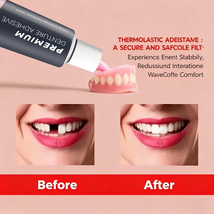 Comfort Denture Adhesives Glue Teeth Care Thermoplastic Denture Silicone Reline Kit Adhesive Cushion Friction Fixed Dentures