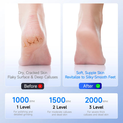 luluskin Electric Foot Callus Remover Exfoliator File Feet Tools Waterproof Foot Exfoliation File Skin and Body Care Appliances