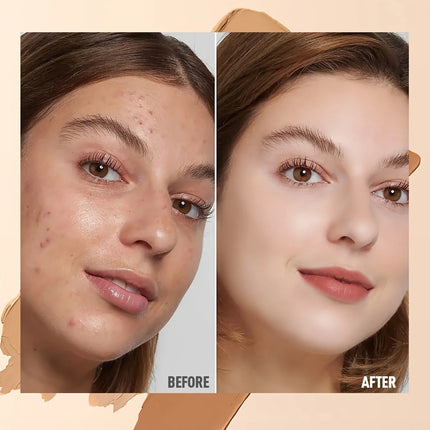 Waterproof Long Lasting Full Coverage for Acne Mark Dark Circles Eye Contour Concealer Palette Moisturizing Face Makeup