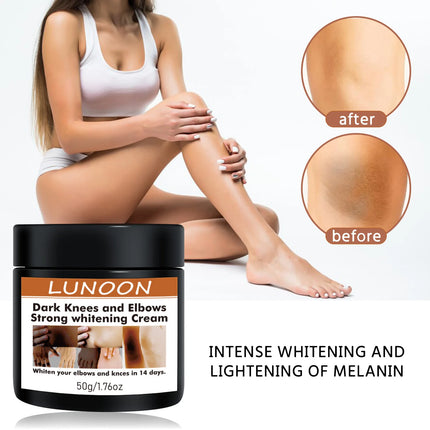 2/1pcs Body Whitening Cream Underarm Bleaching Serum Intense Whiten Butt Knee Brighten Inner Thigh Intimate Dark Remove Melanin