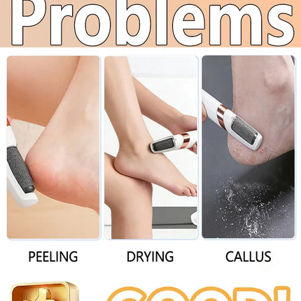 Electric Foot Heel Callus Remover Feet Dead Skin Removal Skin Care Tool Portable Pedicure Rasp Electric foot grinder