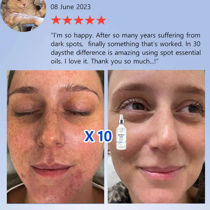 2025 Bestselling Facial Spot-Fading Cream, Effectively Removes Facial Dark Spots