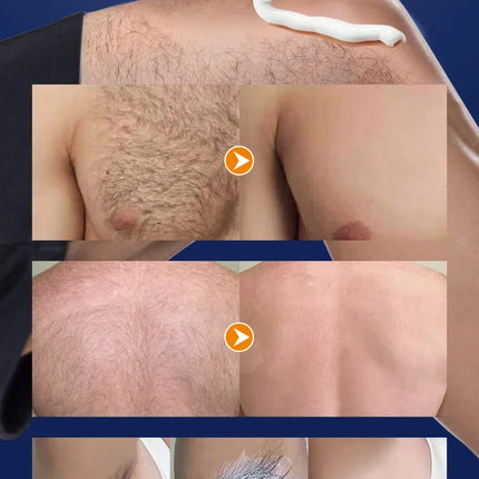 Men's Hair Removal Cream Permanent Epilator Private Area Painless Hair Remover Growth Inhibitor Spray Suitable Sensitive Skin