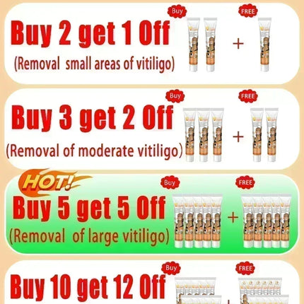 [New] Vitiligo Cream Vitiligo Remover Tinea Versicolor Body Lotion Helps Get Rid of Sweat Spot Vitiligo, Skin Vitiligo Clear