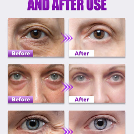 Eye massage instrument, relieve eye fatigue, eliminate eye bags, reduce dark circles, brighten eyes