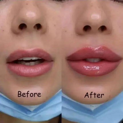 Lip Plump Serum Increase Elasticity Instant Volumising Essential Oil  Moisturize Nourish Reduce Fine Lines Care Cosmetic