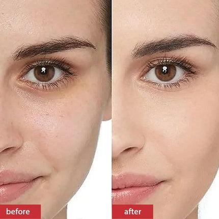 Kojic Acid Cream Remove Pigment Melanin Whitening Remove Dark Spots Cream Nourishing & Resurfacing Fade Skin Care Face Cream
