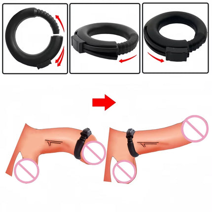 Penis Erection Ring Penis Circumcision Corrector Delayed Ejaculation Locking Cock Ring Adjustable Silicone Adult Products