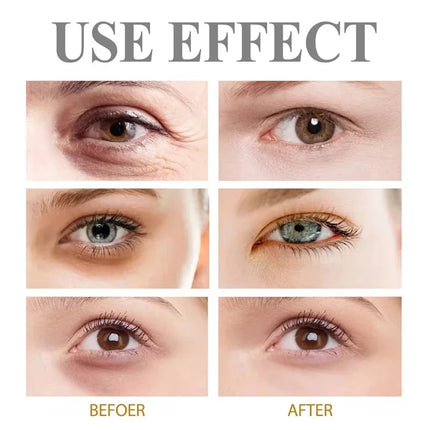 Anti-wrinkle Eye Cream Anti Puffiness Remove Dark Circles Eye Bags Fade Fine Line Firming Skin Moisturizing Eye Care