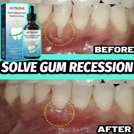 Kit de Limpieza Profunda para Dientes – Blanqueamiento Rápido y Eliminación de Placa