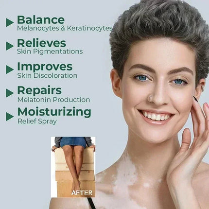 [New] Vitiligo Cream Vitiligo Remover Tinea Versicolor Body Lotion Helps Get Rid of Sweat Spot Vitiligo, Skin Vitiligo Clear