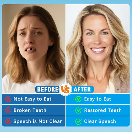 Upper & Lower Full Mouth Silicone Dentures, Lifelike Fake Teeth, Ideal for Daily Oral Care & Confidence Boost