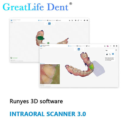 Runyes V3 Pro 3.0 Dental Digital Imaging Scanner Odontológico 3D Intraoral Scanner with Friendly Software & Ortho Simulation