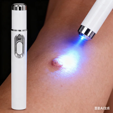 Blue Light Wart Remover Tool Painless Wart Removal Improve Skin Condition Better Life