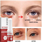 eye cream stick