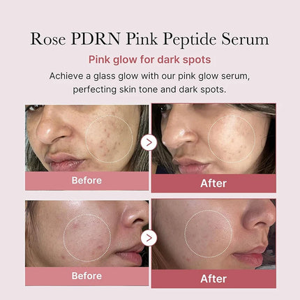 Peptide Collagen Face Serum, Skin Repair & Texture Smoothing Essence, Provides Deep Hydration & Radiance, Korean Beauty Serum