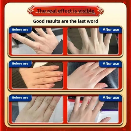Hand cream for removing wrinkles on finger joints, removing hand wrinkles, and reducing joint roughness and blackness