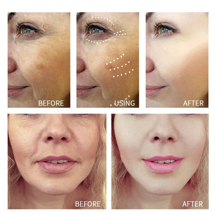 Retinol Wrinkle Remover Cream Shot Tightening Firming Fine Line Enhancer Moisturizing Pore Shrinking Repair Serum Skin Care Set