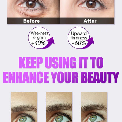Eye massage instrument, relieve eye fatigue, eliminate eye bags, reduce dark circles, brighten eyes