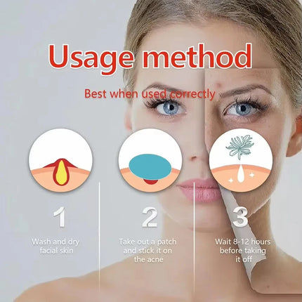 144pcs Invisible Removal Pimple Anti-Acne Hydrocolloid Patches Spots Marks Concealer Repair Sticker Waterproof Beauty-health