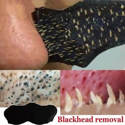 100-10pcs Bamboo Charcoal Tearing Nasal Mask Paste Can Quickly Remove Blackheads and Comedones and Restore A Refreshing Nose