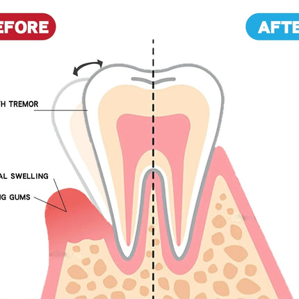 Rapid Repair Gums Gel Effectively Relieve Tooth Allergy Dental Caries Tooth Cleaning Toothpaste Relieve Tooth Damage Serum 665*