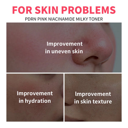 PDRN Niacinamide Toner Lotion Improvement In Hydration Deeply Moisturize Firm Nourishing Enhance Skincare Facial Lotion
