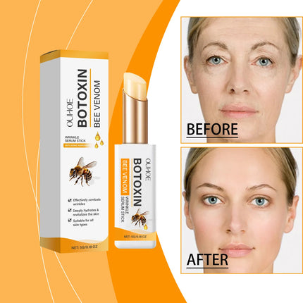 Anti wrinkle eye ointment is used for dark circles, eye bags, and puffiness