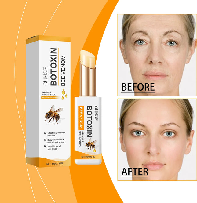 Anti-wrinkle eye ointment is used for dark circles, under-eye bags, and puffiness