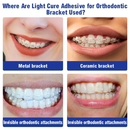 Dental Orthodontic Adhesive Self-cure Kit Etchant Acid Gel Self-cure Paste Primer For Bonding Brackets Buccal Tube