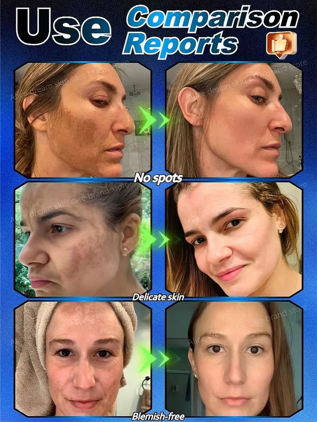 2025 Bestselling Facial Spot-Fading Cream, Effectively Removes Facial Dark Spots