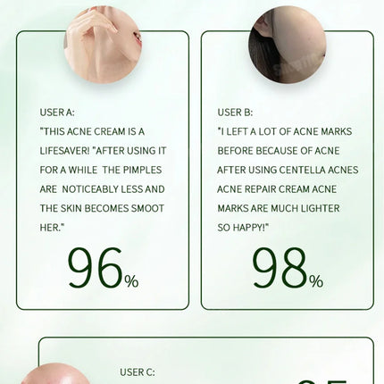 Anti-Acne Cream Effectively Removes Skin Nodules Pustules Cysts Papules Blackheads Men And Women Acne Skin Care Essence Cream