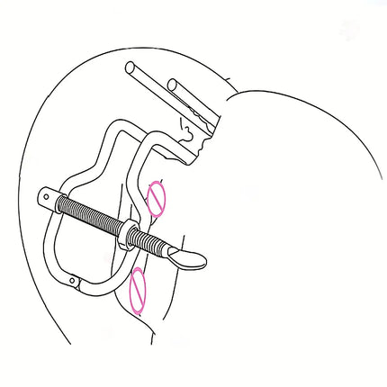 A Unisex Vaginal Anus Clamp Features Large Butt Plug With Metal Expansion Tool For Comprehensive Anal Training Exercises
