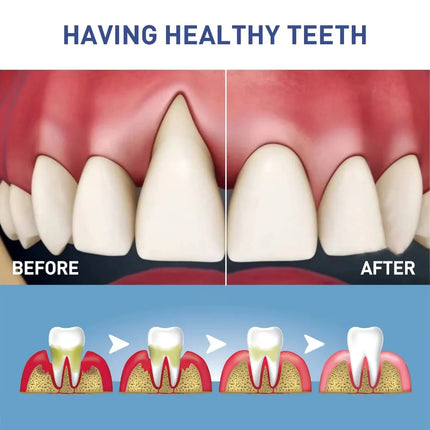 Gum Care Repair Gel - Gentle Oral Hygiene Support for Sensitive Teeth & Gums