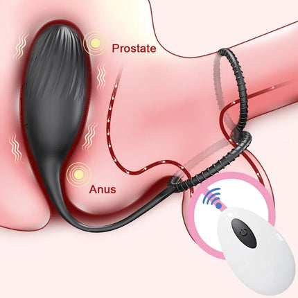 Vibrating Anal Vibrator Prostate Massager Anal Plug Cock Ring for Men Butt Plug for Gay Penis Ring Sex Toy for Male