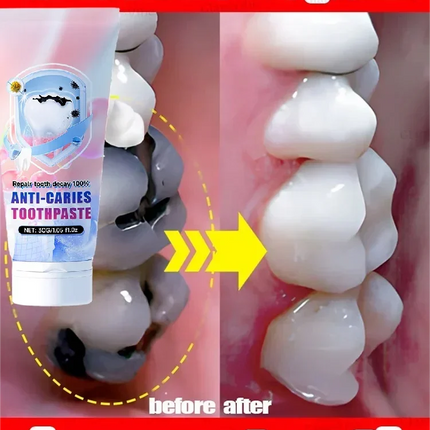 Cavity killer