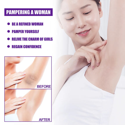 Wholesale Private Parts Lightning Cream Underarm Bleaching Serum Whiten Butt Knee Brighten Intimate Parts Dark Remove