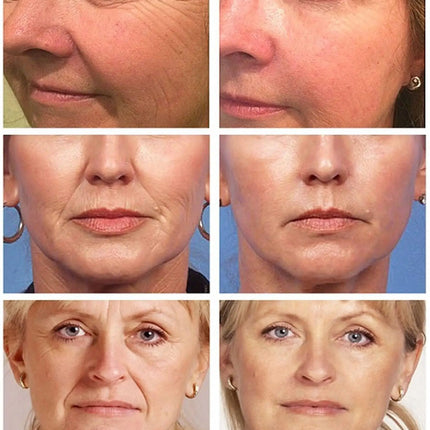 Retinol Wrinkle Remover Face Set Instant Firming Lifting Anti-Aging Serum Fade Fine Lines Whitening Korean Skin Care Products