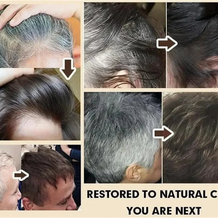 Natural Hair Care Essence Serum Anti Gray Nourish Repair For All Hair Types