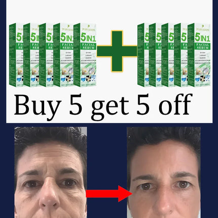 Secrets to a Youthful Appearance Qᵘⁱᶜᵏˡʸ Rᵉᵐᵒᵛᵉ Wʳⁱⁿᵏˡᵉˢ