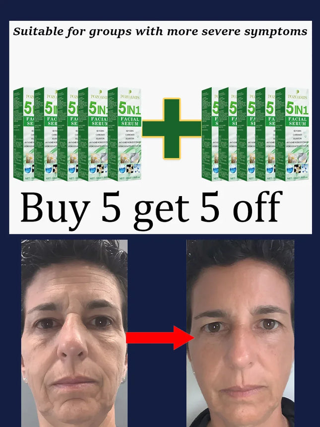 Secrets to a Youthful Appearance Quickly Remove Wrinkles