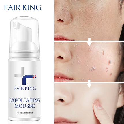 Exfoliating Mousse Improves Skin Texture Gentle Cleansing Makeup Dust Improves Enlarged Pores Oil-control Rosemary Cosmetics