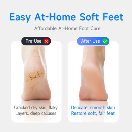 luluskin Electric Pedicure Callus Remover Pedicure Tools Professional Foot Dead Skin Remover Foot Grinder Electric Foot Grinder