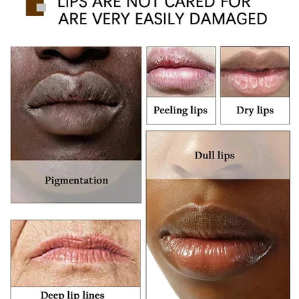 Remove Dark Lip Balm Moisturizing Lighten Melanin Bleaching Lip Gloss Lip Pink Lipstick Exfoliating Fade Lip Line Beauty Health