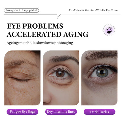 Instant Eye Bag Removal Cream Collagen Anti-Wrinkle Fade Fine Lines Firming Skin Anti Dark Circle Puffiness Brighten Eye Care