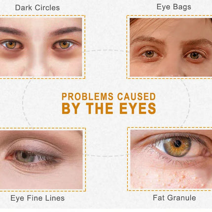 ARTISCARE Gold Osmanthus Eye Mask for Dark Circles Hyaluronic Acid Moisturizing Eye Patches Eye Care