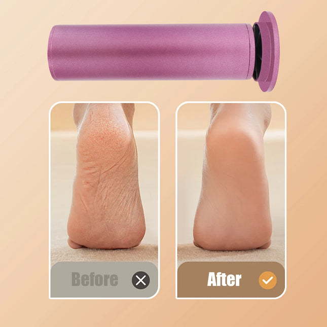 Electric Adjustable Speed Foot Callus Remover Pedicure Tool Manicure Pedicure Suit Dead Skin Callus