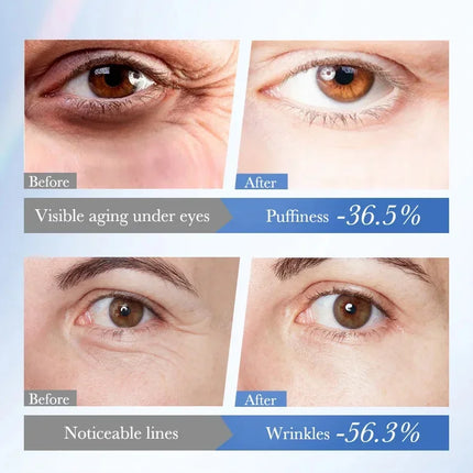 Caviar Eye Bag Removal Cream Hyaluronic Acid Anti-Wrinkle Firming Skin Fade Fine Lines Anti Dark Circle Puffiness Eye Care 20g