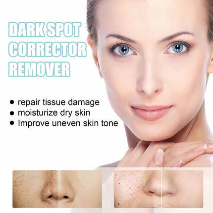 Retinol Whitening And Spot Removing Cream Softens Fine Lines & Wrinkles Repairs Skin Barriers Moisturizing And Brightening Face