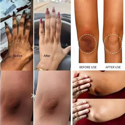 Fast Whitening Dark Knuckles Brighten Hand Cream Melanin Corrector Moisturizing Intense Stains Remover Products Korean Skin Care